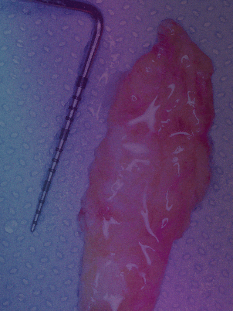 Diplomado en Cirugía Plástica Periodontal 2026 — Técnica Túnel y Recubrimiento Radicular — PerioPlastic